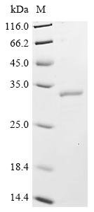 Human CCR4-NOT transcription complex subunit 7 (CNOT7) Recombinant Protein, C-His, Homo sapiens (Human), Yeast, C-terminal 6xHis-tagged, 34.2 kDa, purity >≥ 90% as determined by SDS-PAGE.