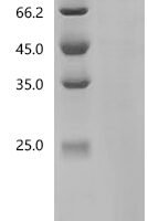 Human Protein O-GlcNAcase (OGA) Recombinant Protein, C-His, aa 1–916, E.coli - BioCrest Sci