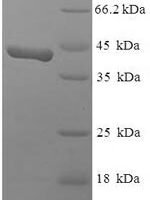 Human SWI/SNF complex subunit SMARCC1 (SMARCC1), partial Recombinant Protein, N-His-SUMO - BioCrest Sci