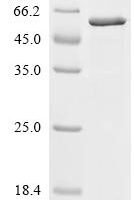 Human Otoferlin (OTOF), partial Recombinant Protein, C-His - BioCrest Sci