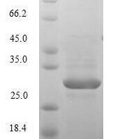 Human Nephrin (NPHS1), partial Recombinant Protein, N-10His - BioCrest Sci