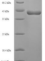 Schistosoma mansoni Major egg antigen Recombinant Protein - BioCrest Sci