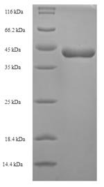 Schistosoma mansoni Major egg antigen Recombinant Protein, Schistosoma mansoni (Blood fluke), Yeast, N-terminal 6xHis-tagged, 41.4 kDa, purity >≥ 90% as determined by SDS-PAGE.