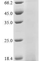 Woodchuck hepatitis B virus Protein X (X),partial Recombinant Protein, N-His - BioCrest Sci