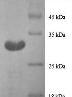 Human Metallothionein-1G (MT1G), partial Recombinant Protein - BioCrest Sci