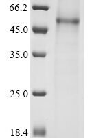 Hantaan virus Envelopment polyprotein (GP), partial Recombinant Protein, C-His, aa 649–1105, Baculovirus - BioCrest Sci