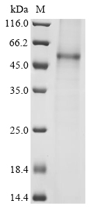 Hantaan virus Envelopment polyprotein (GP), partial Recombinant Protein, C-His, aa 649–1105, Baculovirus, Hantaan virus (strain 76-118) (Korean hemorrhagic fever virus), Baculovirus, C-terminal 6xHis-tagged, 56.1 kDa, purity >≥ 85% as determined by SDS-PAGE.
