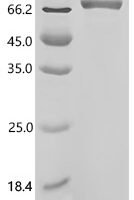 Mouse Spectrin beta chain, non-erythrocytic 1 (Sptbn1), partial Recombinant Protein, C-hFc1 - BioCrest Sci