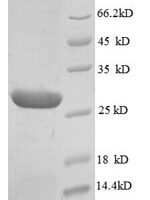Human Scaffold protein ILK (ILK), partial Recombinant Protein - BioCrest Sci