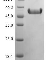 Mouse CCN family member 2 (Ccn2), partial Recombinant Protein, N-GST - BioCrest Sci