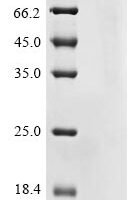 Medicago truncatula LysM domain protein (MTR_4g091010) Recombinant Protein - BioCrest Sci