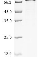 Human Desmin (DES) Recombinant Protein, C-EGFP - BioCrest Sci