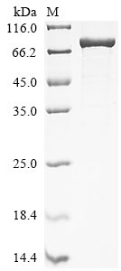 Human Desmin (DES) Recombinant Protein, C-EGFP, Homo sapiens (Human), E.coli, C-terminal EGFP-tagged, 80.5 kDa, purity >≥ 85% as determined by SDS-PAGE.