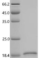 Human Fibroblast growth factor 1 (FGF1) Recombinant Protein, N-His, aa 16–155, Yeast - BioCrest Sci