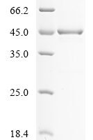 Yersinia enterocolitica serotype O:8 / biotype 1B Propionate kinase (tdcD) Recombinant Protein, N-His - BioCrest Sci