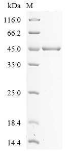Yersinia enterocolitica serotype O:8 / biotype 1B Propionate kinase (tdcD) Recombinant Protein, N-His, Yersinia enterocolitica serotype O:8 / biotype 1B (strain NCTC 13174 / 8081), E.coli, N-terminal 6xHis-tagged, 49.9 kDa, purity >≥ 85% as determined by SDS-PAGE.