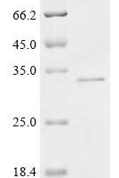 Human Protein phosphatase PTC7 homolog (PPTC7) Recombinant Protein - BioCrest Sci