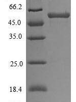 Human E3 ubiquitin-protein ligase TRAIP (TRAIP) Recombinant Protein, N-His - BioCrest Sci