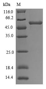 Human E3 ubiquitin-protein ligase TRAIP (TRAIP) Recombinant Protein, N-His, Homo sapiens (Human), E.coli, N-terminal 6xHis-tagged, 58.8 kDa, purity >≥ 85% as determined by SDS-PAGE.