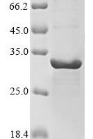 Human Phosphatidylinositol 4,5-bisphosphate 3-kinase catalytic subunit gamma isoform (PIK3CG), partial Recombinant Protein - BioCrest Sci