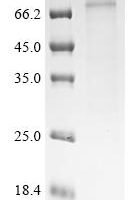 Mouse Beta-1 adrenergic receptor (Adrb1) Recombinant Protein - BioCrest Sci