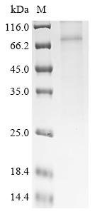 Mouse Beta-1 adrenergic receptor (Adrb1) Recombinant Protein, Mus musculus (Mouse), in vitro E.coli expression system, N-terminal 6xHis-SUMO-tagged, 63.4 kDa, purity >≥ 85% as determined by SDS-PAGE.