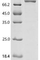Mouse Tyrosine-protein kinase BTK (Btk) Recombinant Protein - BioCrest Sci