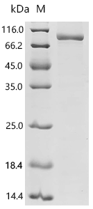 Mouse Tyrosine-protein kinase BTK (Btk) Recombinant Protein, Mus musculus (Mouse), E.coli, C-terminal 6xHis-tagged, 83.2 kDa, purity >≥ 85% as determined by SDS-PAGE.
