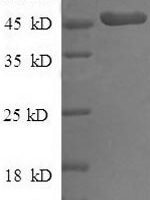 Human Fibroblast growth factor 19 protein (FGF-19)
, partial Recombinant Protein - BioCrest Sci