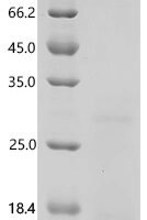 Mouse Protransforming growth factor alpha (Tgfa), partial Recombinant Protein, C-His - BioCrest Sci
