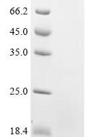 Bovine Seizure 6-like protein 2 (SEZ6L2), partial Recombinant Protein - BioCrest Sci