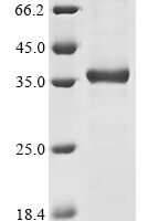 Human Probable G-protein coupled receptor 132 (GPR132), partial Recombinant Protein - BioCrest Sci