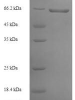 Rabies virus Glycoprotein (G), partial Recombinant Protein, N-His-SUMO - BioCrest Sci