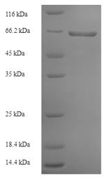 Rabies virus Glycoprotein (G), partial Recombinant Protein, N-His-SUMO, Rabies virus (strain PM) (RABV), E.coli, N-terminal 6xHis-SUMO-tagged, 65.5 kDa, purity >≥ 90% as determined by SDS-PAGE.