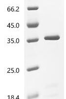 Discosoma sp. Red fluorescent protein drFP583 Recombinant Protein - BioCrest Sci