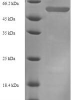 Mouse Plasminogen activator inhibitor 1 (Serpine1) Recombinant Protein, N-His-SUMO - BioCrest Sci