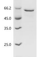 Human RNA-binding protein Nova-1 (NOVA1) Recombinant Protein, N-10His/C-Myc - BioCrest Sci