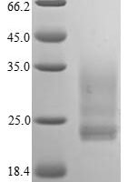 Human Interleukin-1 alpha (IL1A) Recombinant Protein, C-His - BioCrest Sci