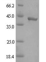 Porphyromonas gingivalis Gingipain R2 (rgpB), partial Recombinant Protein, N-His-SUMO - BioCrest Sci