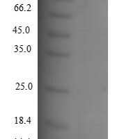 Human C-C motif chemokine 8 (CCL8) Recombinant Protein, N-His - BioCrest Sci