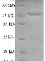 Human Lysosomal acid lipase/cholesteryl ester hydrolase (LIPA) Recombinant Protein, N-GST - BioCrest Sci