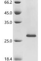 Human papillomavirus 35 Protein E7 (E7) Recombinant Protein - BioCrest Sci