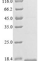 Human C-C chemokine receptor type 7 (CCR7), partial Recombinant Protein - BioCrest Sci