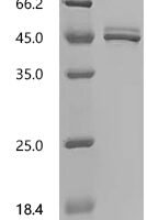 Human Somatostatin (SST) Recombinant Protein - BioCrest Sci