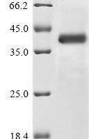 Human NACHT, LRR and PYD domains-containing protein 1 (NLRP1) Recombinant Protein - BioCrest Sci