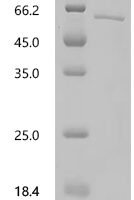 Human Histidine decarboxylase (HDC), partial Recombinant Protein, N-10His/C-Myc - BioCrest Sci