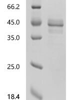 Human NADH dehydrogenase [ubiquinone] iron-sulfur protein 6, mitochondrial（NDUFS6) Recombinant Protein, C-hFc1 - BioCrest Sci