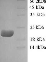 Sheep Interleukin-10 (IL10) Recombinant Protein - BioCrest Sci