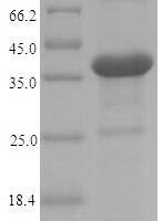 Yersinia enterocolitica Invasin, partial Recombinant Protein - BioCrest Sci