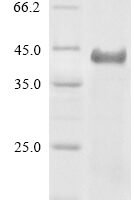 Human Serine--pyruvate aminotransferase (AGXT) Recombinant Protein, N-His, aa 1–392, Yeast - BioCrest Sci